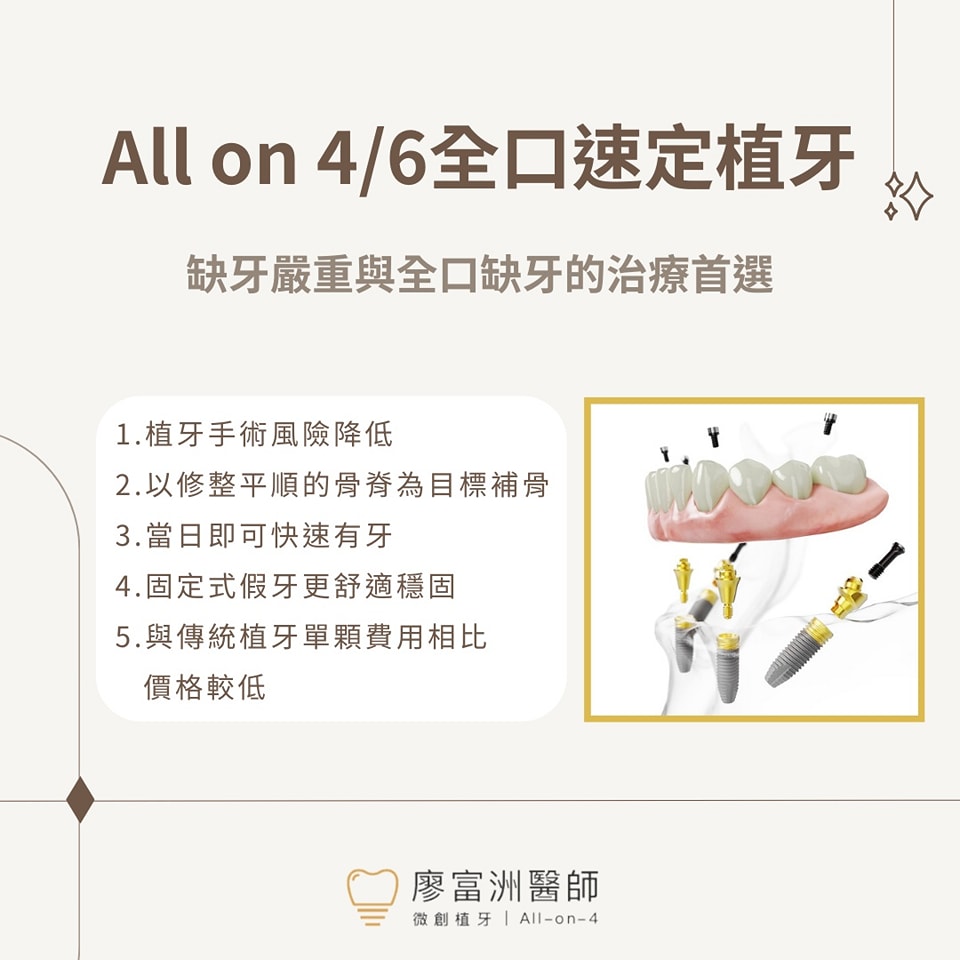什麼是All-on-4植牙